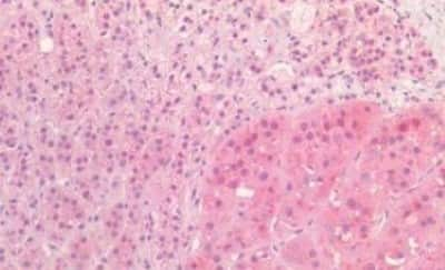 Immunohistochemistry-Paraffin: Proenkephalin Antibody [NBP3-14448]